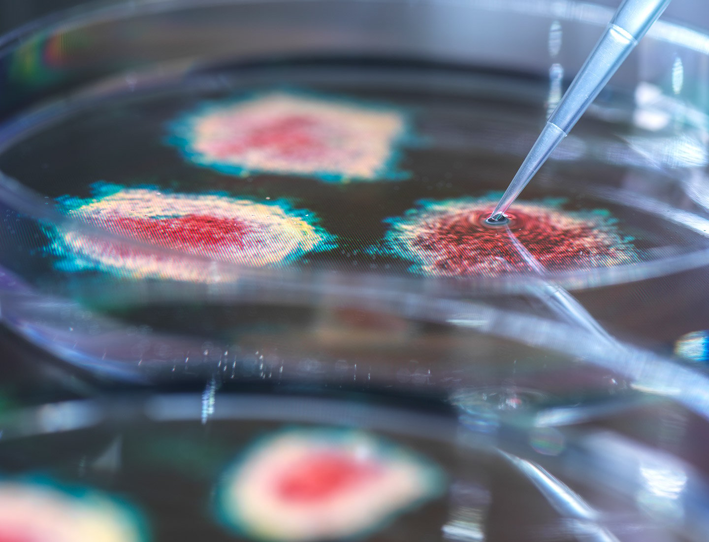 Bacteria in a Petri dish.