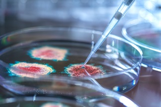 Bacteria in a Petri dish.