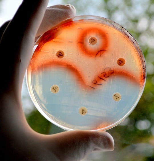 Virologist examines bacteria in a Petri dish